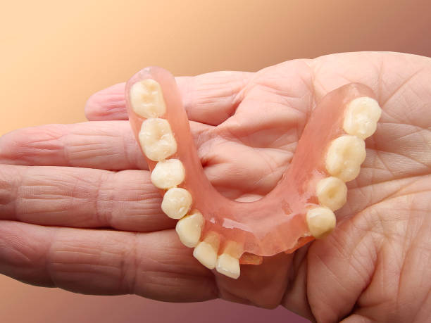 Flexible Dentures