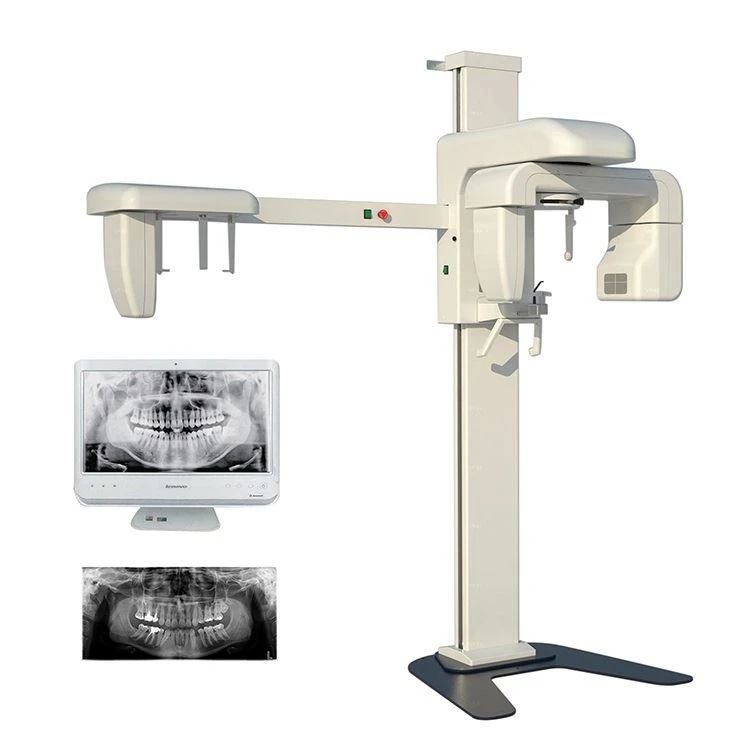 Intraoral Scanner